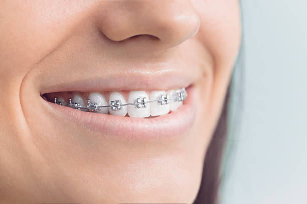 Best Invisalign and Clear Aligners  in Freeland, WA